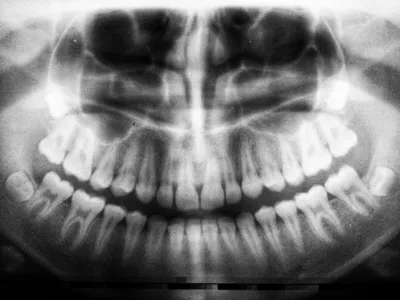 New Technology for Sydney Denture Clinic Using 3D ImagingIllustration