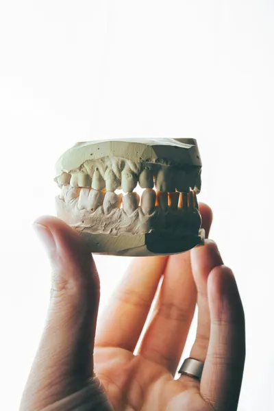 Navigating Root Canal Therapy: A Comprehensive GuideIllustration