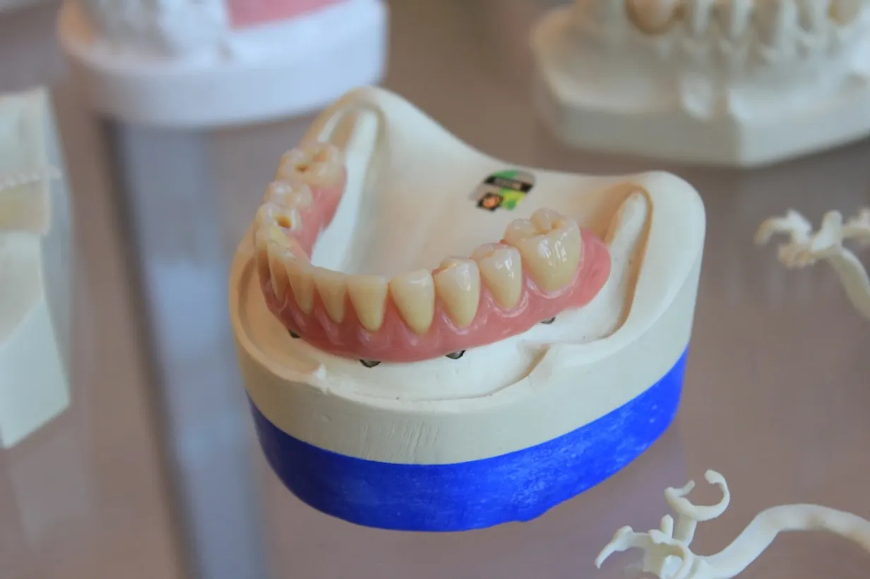 The Future of Dental Fillings: Innovations and AdvancementsIllustration