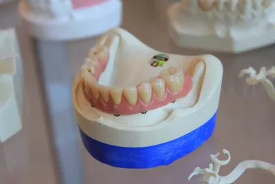 The Future of Dental Fillings: Innovations and AdvancementsIllustration